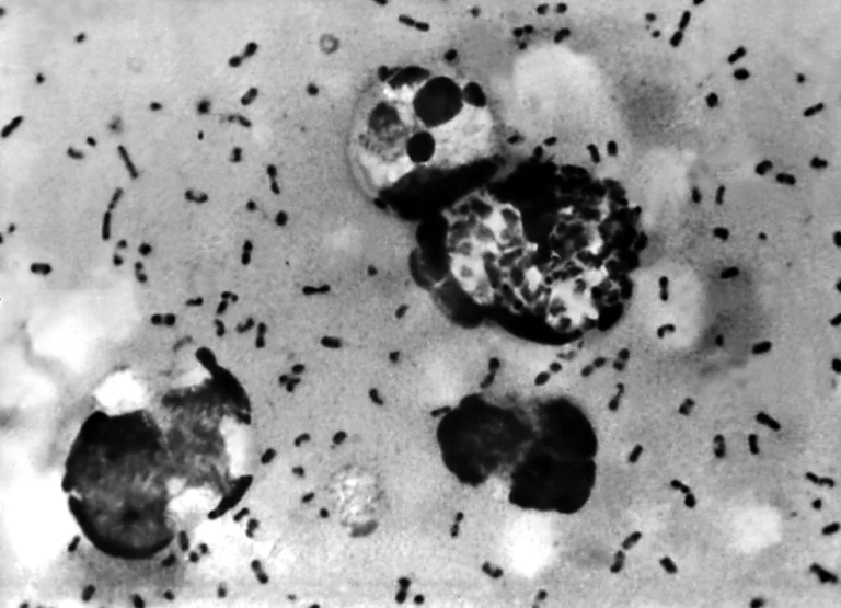 Rússia conclui inspeções após morte em laboratório por pneumonia misteriosa